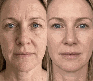 Veronica T., 44 Jahre